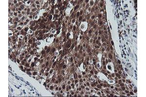 Image no. 3 for anti-Cytidine Monophosphate (UMP-CMP) Kinase 1, Cytosolic (CMPK1) antibody (ABIN1497541)