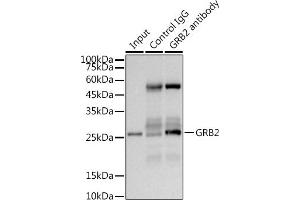 Immunoprecipitation analysis of 300 μg extracts of 293T cells using 3 μg GRB2 antibody (ABIN7267518).