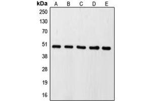 Western blot analysis of Caspase 9 expression in HeLa (A), HEK293T (B), SP2/0 (C), mouse kidney (D), rat lung (E) whole cell lysates. (Caspase 9 anticorps  (Center))
