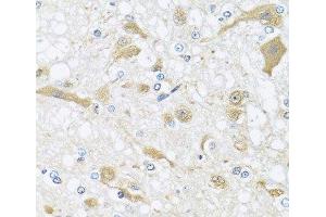 Immunohistochemistry of paraffin-embedded Rat brain using APOL1 Polyclonal Antibody at dilution of 1:100 (40x lens). (APOL1 anticorps)