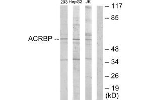 Western blot analysis of extracts from 293 cells, HepG2 cells and Jurkat cells, using ACRBP antibody.