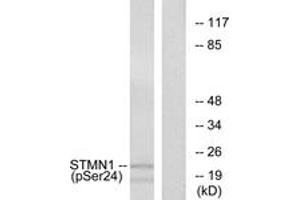 Western blot analysis of extracts from Jurkat cells treated with PMA 1ng/ml 15', using Stathmin 1 (Phospho-Ser24) Antibody. (Stathmin 1 anticorps  (pSer25))