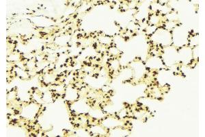 ABIN6273098 at 1/100 staining Mouse lung tissue by IHC-P.