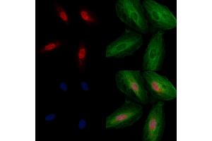 ABIN6265046 and ABIN6272880 staining  cells by IF/ICC.