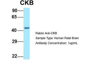 Host: Rabbit  Target Name: CKB  Sample Tissue: Human Fetal Brain  Antibody Dilution: 1. (CKB anticorps  (C-Term))