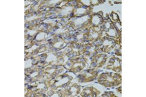 Immunohistochemistry of paraffin-embedded mouse stomach using TRMT2A antibody. (TRMT2A anticorps  (C-Term))