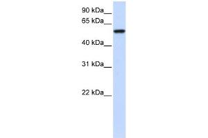 WB Suggested Anti-ZNF675 Antibody Titration: 0. (ZNF675 anticorps  (N-Term))