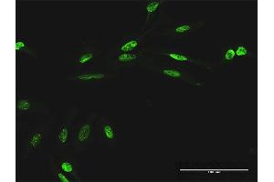Immunofluorescence of purified MaxPab antibody to RIOK1 on HeLa cell.