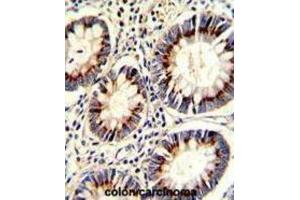 Immunohistochemistry (IHC) image for anti-Thymidylate Synthetase (TYMS) antibody (ABIN3002747)