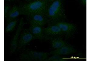 Immunofluorescence of monoclonal antibody to POU5F1 on A-549 cell.