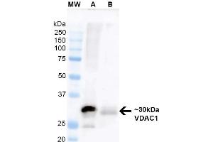 Western Blot analysis of Mouse Brain and Human RT-4 lysates showing detection of ~30 kDa VDAC1 protein using Mouse Anti-VDAC1 Monoclonal Antibody, Clone S152B-23 (ABIN1741231).
