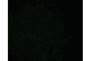 Immunofluorescence staining of phosphoserine/threonine (clone 22A, MN ABIN968873) on A431 cells (Human epithelial carcinoma, ATCC CRL-1555). (Phosphoserine/Threonine anticorps)