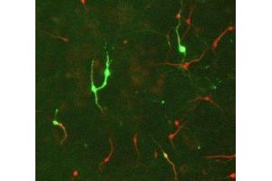 Immunostaining of E17 rat midbrain mixed neuronal cultures showing TH positive neurons in green and MAP2 (ABIN361345) in red. (Tyrosine Hydroxylase anticorps)