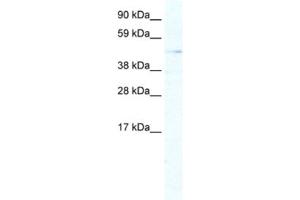 Western Blotting (WB) image for anti-Aristaless Related Homeobox (ARX) antibody (ABIN2461424)