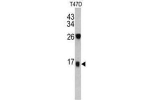Image no. 1 for anti-Dermcidin (DCD) (C-Term) antibody (ABIN452901) (Dermcidin anticorps  (C-Term))