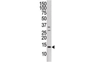 Western blot analysis of DUSP15 antibody and CEM cell line lysate.