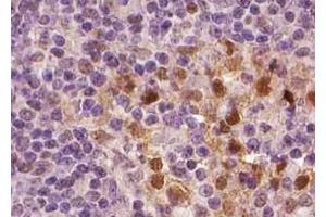 ABIN6267001 at 1/100 staining human Lymph node tissue sections by IHC-P. (Bcl-2 anticorps  (Internal Region))