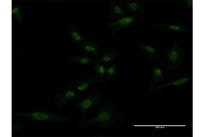 Immunofluorescence of monoclonal antibody to SH2D3A on HeLa cell.