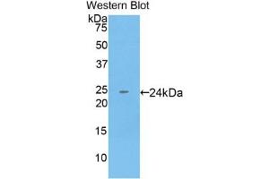 Detection of Recombinant KRT18, Human using Monoclonal Antibody to Cytokeratin 18 (CK18)