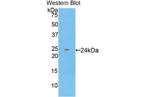 Detection of Recombinant KRT18, Human using Monoclonal Antibody to Cytokeratin 18 (CK18) (Cytokeratin 18 anticorps  (AA 238-396))