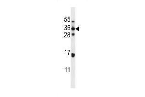 Western blot analysis in MDA-MB435 cell line lysates (35ug/lane). (ELOVL5 anticorps  (C-Term))