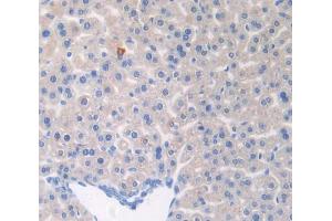 Used in DAB staining on fromalin fixed paraffin- embedded liver tissue