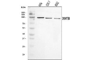 Western blot analysis of DNMT3B using anti-DNMT3B antibody (ABIN7600778).