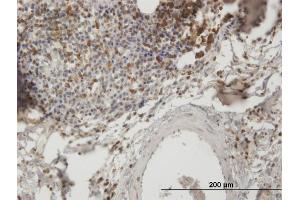 Immunoperoxidase of purified MaxPab antibody to SH3KBP1 on formalin-fixed paraffin-embedded human lymph node.