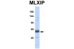 Host:  Rabbit  Target Name:  MLXIP  Sample Type:  Human Fetal Muscle  Antibody Dilution:  1. (MLXIP anticorps  (Middle Region))