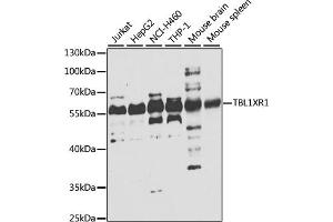 Western blot analysis of extracts of various cell lines, using TBL1XR1 antibody (ABIN6132718, ABIN6148894, ABIN6148896 and ABIN6223805) at 1:1000 dilution. (TBL1XR1 anticorps  (AA 1-180))