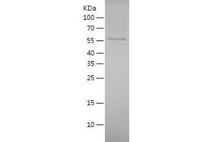 Western Blotting (WB) image for Cadherin 18, Type 2 (CDH18) (AA 54-608) protein (His-IF2DI Tag) (ABIN7122073)