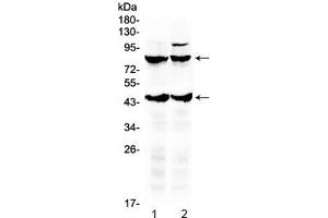 Western blot testing of 1) rat brain and 2) mouse brain lysate with TSH Receptor antibody. (TSHR, B Chain anticorps  (AA 515-538))