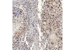 IHC analysis of U1A/SNRPA using anti-U1A/SNRPA antibody (ABIN7600891). (SNRPA1 anticorps  (AA 25-218))