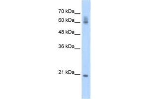 Western Blotting (WB) image for anti-FIP1 Like 1 (FIP1L1) antibody (ABIN2462308) (FIP1L1 anticorps)