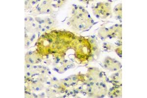 IHC analysis of ATP citrate lyase using anti-ATP citrate lyase antibody (ABIN6719406).