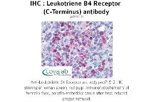 Image no. 1 for anti-Leukotriene B4 Receptor (LTB4R) (C-Term) antibody (ABIN1736425)