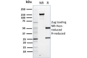 SDS-PAGE Analysis Purified FOXP3 Monoclonal Antibody (FXP3/197).