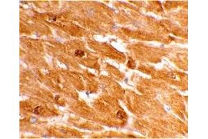 Immunohistochemistry (IHC) image for anti-Caspase 12 (Gene/pseudogene) (CASP12) (Large Isoform) antibody (ABIN1031699)