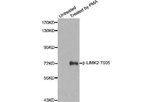 Western blot analysis of extracts from Hela cells, using Phospho-LIMK2-T505 antibody. (LIMK2 anticorps  (pThr505))