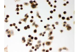 IHC analysis of CLOCK using anti-CLOCK antibody .
