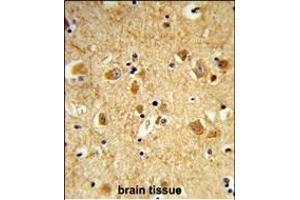 Formalin-fixed and paraffin-embedded human brain tissue reacted with DNM3 Antibody (Center), which was peroxidase-conjugated to the secondary antibody, followed by DAB staining.