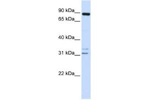 ADAM19 antibody used at 1 ug/ml to detect target protein.