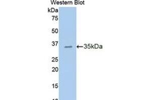 Detection of Recombinant CDHE, Human using Polyclonal Antibody to E-cadherin