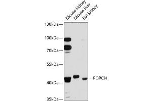 Western blot analysis of extracts of various cell lines, using PORCN antibody (ABIN6131340, ABIN6145972, ABIN6145974 and ABIN6215858) at 1:3000 dilution.