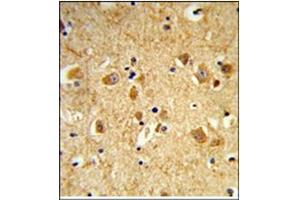 AP17991PU-N Dynamin-3 antibody staining of Formalin-Fixed, Paraffin-Embedded Human brain using Peroxidase-conjugated to the secondary antibody, followed by DAB staining.
