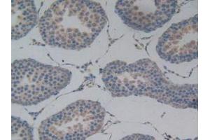 IHC-P analysis of Rat Testis Tissue, with DAB staining. (PODXL anticorps  (AA 153-386))