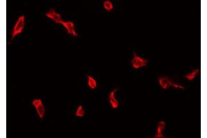 ABIN6272287 staining COLO205 by IF/ICC. (ZDHHC9 anticorps  (C-Term))