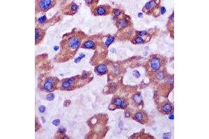 Immunohistochemistry (IHC) image for anti-Ribosomal Protein L14 (RPL14) antibody (ABIN7308284)