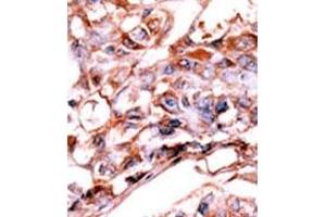 Image no. 2 for anti-V-Erb-A erythroblastic Leukemia Viral Oncogene Homolog 4 (Avian) (ERBB4) (pTyr1188) antibody (ABIN358140) (ERBB4 anticorps  (pTyr1188))