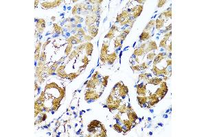 Immunohistochemistry of paraffin-embedded human stomach using HY antibody  at dilution of 1:100 (40x lens). (HYAL1 anticorps  (AA 136-435))